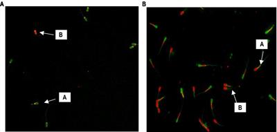 Effect of selenium nanoparticles on the quality and fertility of short-term preserved boar semen